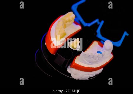 Scanner dentale 3D per la scansione e la misurazione di modelli dentale in gesso - primo piano Foto Stock