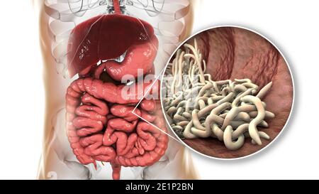 Vermi rotondi nell'intestino umano, illustrazione Foto Stock