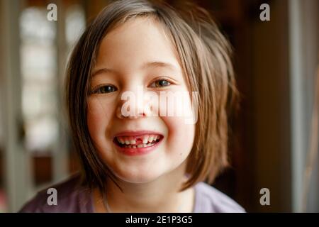 primo piano di orgogliosa bambina che mostra il dente mancante con grande sorriso Foto Stock