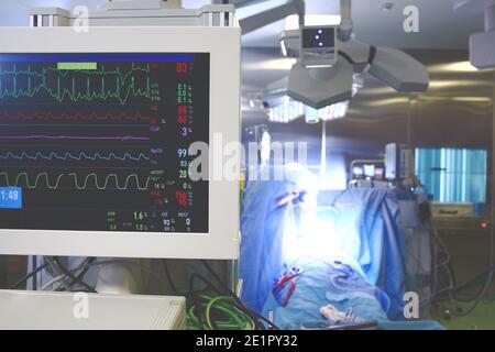 Processo di lavoro in sala operatoria ospedaliera con persone e tecnologia. Foto Stock