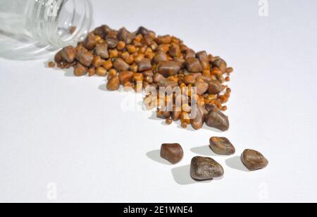 Calcoli biliari e vaso di campione, pietre da sola operazione su sfondo bianco. Foto Stock