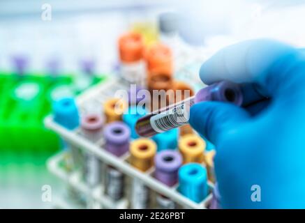 Tecnico medico che prepara campioni umani per le analisi mediche in laboratorio Foto Stock