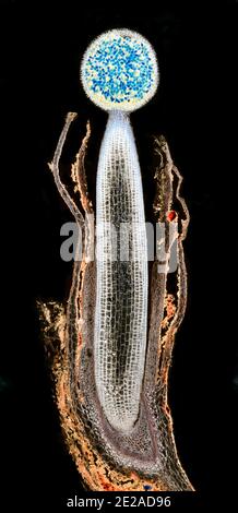 Liverwort pellia LS. Sporogonio, fotomicrografia a campo scuro Foto Stock