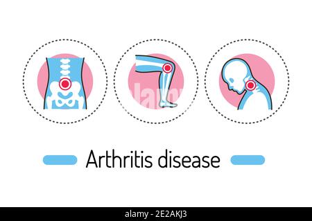 Artrite malattia concetto di contorno. Infiammazione delle articolazioni icone di colore delle linee. Pittogrammi per pagina Web, app mobile, promo. Illustrazione Vettoriale