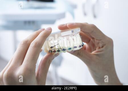 Primo piano di una persona che tiene una serie di denti simulati con bretelle colorate Foto Stock