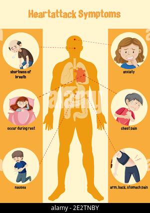 Informazioni sui sintomi dell'attacco cardiaco illustrazione infografica Illustrazione Vettoriale