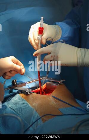 Lavoro di squadra chirurgico nella sala operatoria. Foto Stock