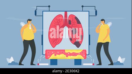 Il fumo è causa di broncopneumopatia cronica ostruttiva o BPCO. I polmoni hanno problemi respiratori e un flusso d'aria insufficiente. Illustrazione vettoriale in design piatto. Illustrazione Vettoriale