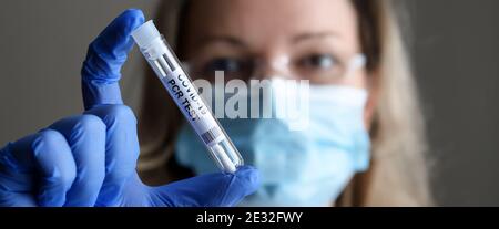 COVID-19 kit di raccolta tampone in mani mediche, vista panoramica della donna in maschera medica contenente il tubo del test PCR del coronavirus. Concetto di corona virus di Foto Stock