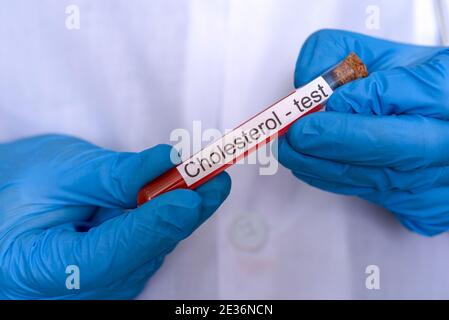 Mani in guanti medici tenere un pallone di sangue per un test del colesterolo. Il concetto di ricerca e sviluppo medico. Foto Stock