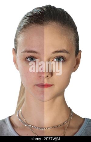 bella giovane donna su sfondo bianco, concetto di bellezza. ritocco prima e dopo. viso diviso in due parti, cattivo stato della pelle e buono Foto Stock