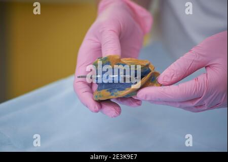 Chirurgia dentale. Tecnico dentale che fa le dentiere. Protesi dentaria nelle mani mediche prima del lavoro di protesi. Foto Stock