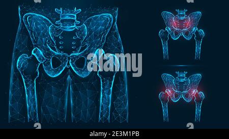 Ossa del bacino e dell'anca, anatomia umana. Lesioni pelviche e dell'anca. Raggi X dell'articolazione dell'anca costituiti da linee e punti isolati su sfondo blu. Illustrazione Vettoriale