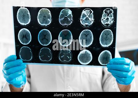 Mani di un medico che tiene la scansione rm della testa Foto Stock