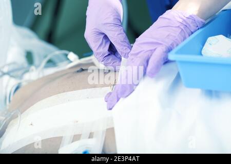 Il medico sta cambiando le bende al paziente dopo l'intervento chirurgico. Foto Stock