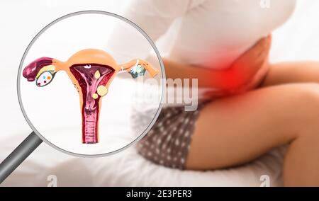 Endometriosi, modello virtuale dell'utero, primo piano. Donna che soffre di dolore mestruale, mentre si siede a letto. Dolore allo stomaco Foto Stock