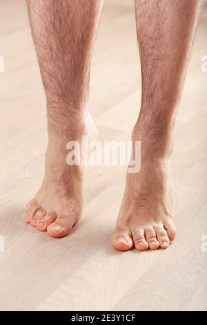 l'uomo che fa la ginnastica di correzione del piede piatto che si alza sulle punte a casa Foto Stock