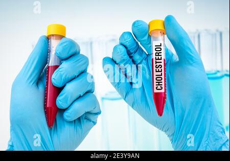 Gli scienziati tengono una provetta con un campione di sangue per IL COLESTEROLO test Foto Stock