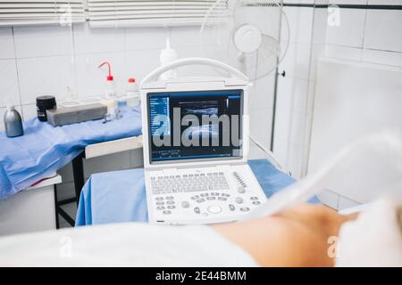 Macchina a ultrasuoni su un tavolo con un panno blu accanto ad un paziente sdraiato su una barella in un ospedale Foto Stock