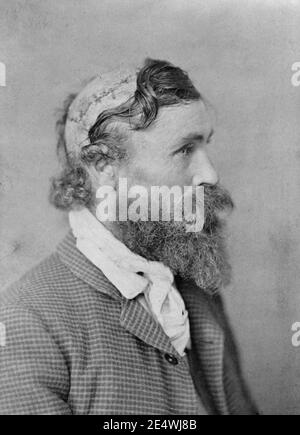Robert McGee, scalpato come un bambino da Sioux Chief Little Turtle nel 1864. Foto Stock