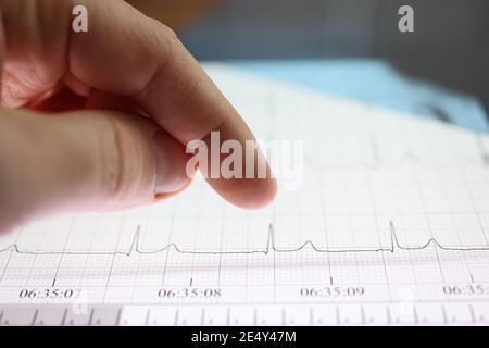 Pollice sopra la compressa con immagine del cardiogramma Foto Stock