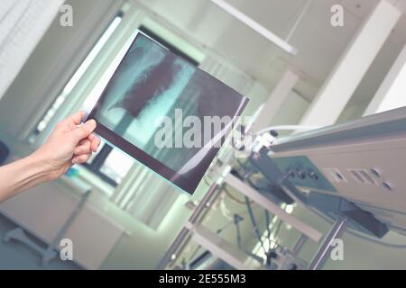 Il medico esamina la pellicola di controllo R del polmone del paziente. Foto Stock