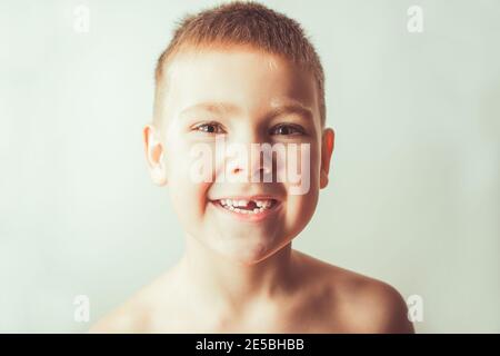 Concetto di odontoiatria pediatrica. Ragazzo emozionale carino senza un dente. Foto Stock