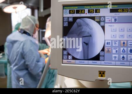 un medico sta operando su una spalla in un operatorio stanza e in primo piano è una macchina a raggi x. Foto Stock