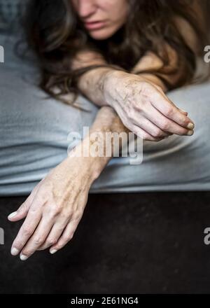 Autolesionismo su una donna malata frustrata e disillusa che si trova a letto con pesanti tagli e cicatrici di auto-mutilazione in frustrazione, abusivo Foto Stock