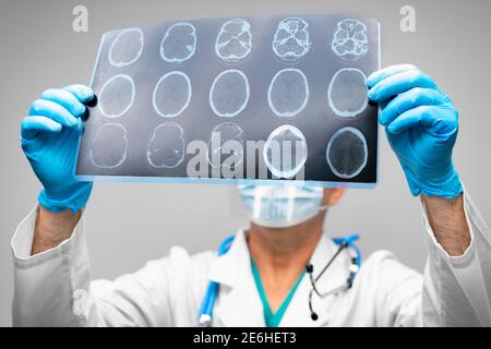 Mani di un medico che tiene la scansione rm della testa Foto Stock