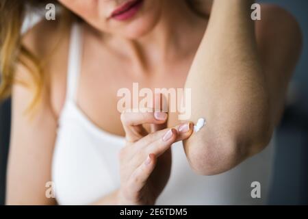 Applicazione della crema sulla mano sana della pelle asciutta Foto Stock