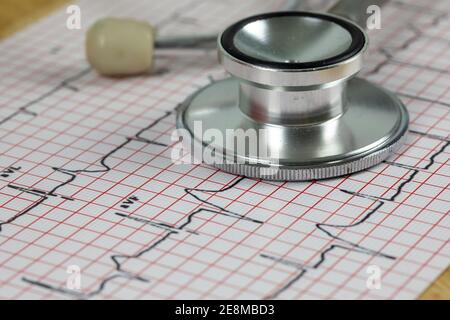 Concetto di attacco cardiaco, stetoscopio nella parte superiore della mappa ECG Foto Stock