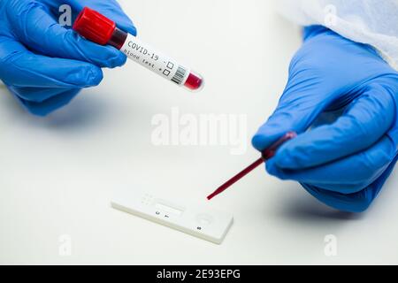 Scienziato tecnico del laboratorio britannico che colloca il campione di sangue su Rapid Diagnostic Test cassetta RDT, tecnico medico che esegue test PRP sangue rapido identificare Foto Stock