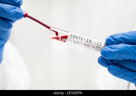 Tecnico di laboratorio che rilascia il campione di sangue nel contenitore della provetta mediante Pipettare, procedura di analisi del sangue COVID-19, mettere in primo piano le mani nei guanti spec Foto Stock