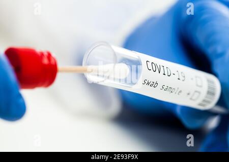 rt-PCR COVID-19 test diagnostico della malattia da virus, tecnico di laboratorio britannico che indossa blu Guanto di protezione per provette con bastoncino di swabbing, DNA nasale e. orale Foto Stock