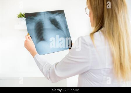 Attraente medico femminile in un cappotto bianco, con uno stetoscopio sul collo tiene una radiografia nelle sue mani, considera molto x-ray.Examination dei pazienti Foto Stock