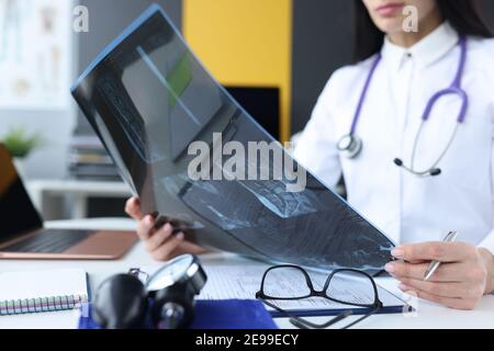 Medico femminile che tiene raggi X nelle mani in clinica closeup Foto Stock