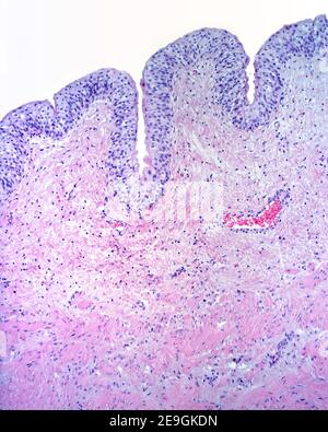 Mucosa della vescica urinaria formata da un epitelio transitorio e una lamina propria di tessuto connettivo. Sotto, lo strato muscolare formato dal fumo Foto Stock