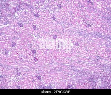 Micrografia a basso ingrandimento che mostra la corteccia di un rene umano. I glomeruli appaiono come strutture rotonde separate da tubuli convoluti. Il orizzontale Foto Stock