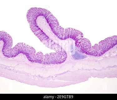 Lieberkühn cripte di una mucosa del colon umano che mostrano abbondanti ...