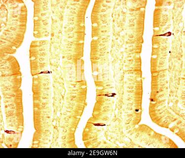 Cellule argirofile nell'epitelio dei villi dell'intestino tenue. Sono cellule enteroendocrine (ad esempio, cellule secretiniche S). Foto Stock