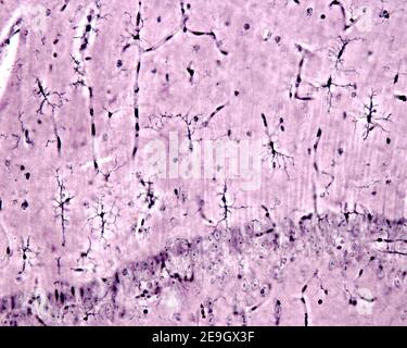 Micrografia ad alto ingrandimento che mostra le cellule microgliali della regione CA1 dell'ippocampo (Ammon Horn). Metodo Rio-Hortega (carbonato d'argento) Foto Stock