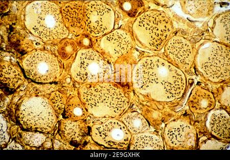 Neuroni pseudounipolari di un ganglio di radice dorsale. Metodo argento per apparecchi Golgi. I Dictyosomes si trovano nel soma tranne che nel hillock dell'assone Foto Stock