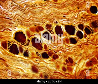 Neuroni pseudounipolari di una radice dorsale. L'assone di quei neuroni lascia il corpo cellulare e segue un percorso convoluto, il cosiddetto glomerulo iniziale Foto Stock