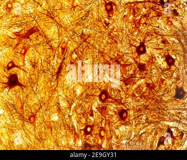 Neuroni multipolari del corno anteriore del midollo spinale. Nitrato d'argento di Cajal Foto Stock