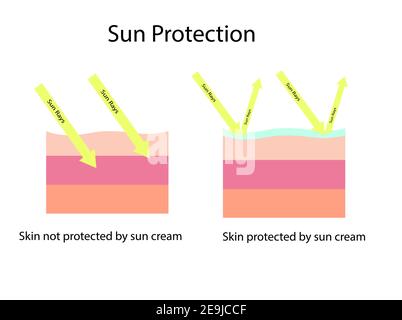 La pelle confronta la pelle con la crema solare ad ampio spettro protegge entrambi gli UVA E UVB e normale schermo solare che non possono proteggere UVA Illustrazione Vettoriale