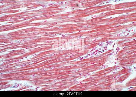 Muscolo cardiaco umano, micrografia leggera Foto Stock