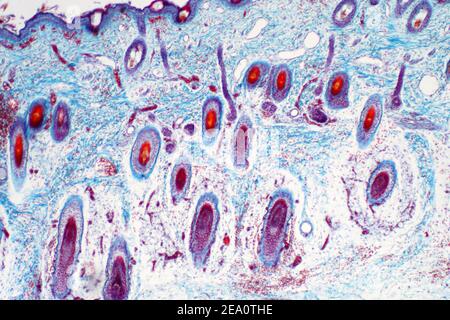 Pelle umana, micrografia leggera Foto Stock