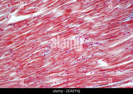 Muscolo cardiaco umano, micrografia leggera Foto Stock