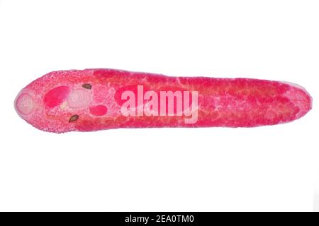 LIVER fluke, micrografia leggera Foto Stock